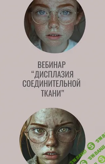Дисплазия соединительной ткани [Chudesnij.oma] [Олеся Скребцова]