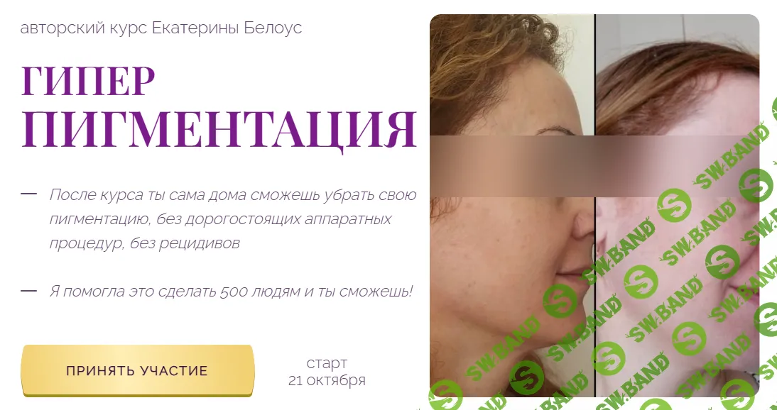 [Екатерина Белоус] Гиперпигментация (2024)
