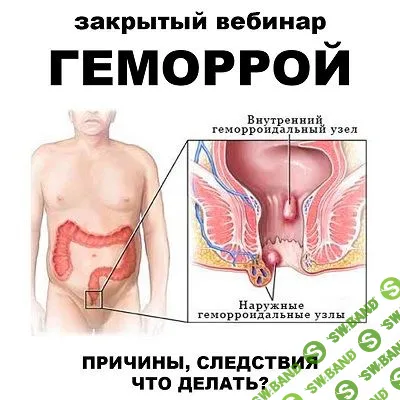 Геморрой [pravda.pro.pisheprom] [Женя Братишка, Юля Братишка]