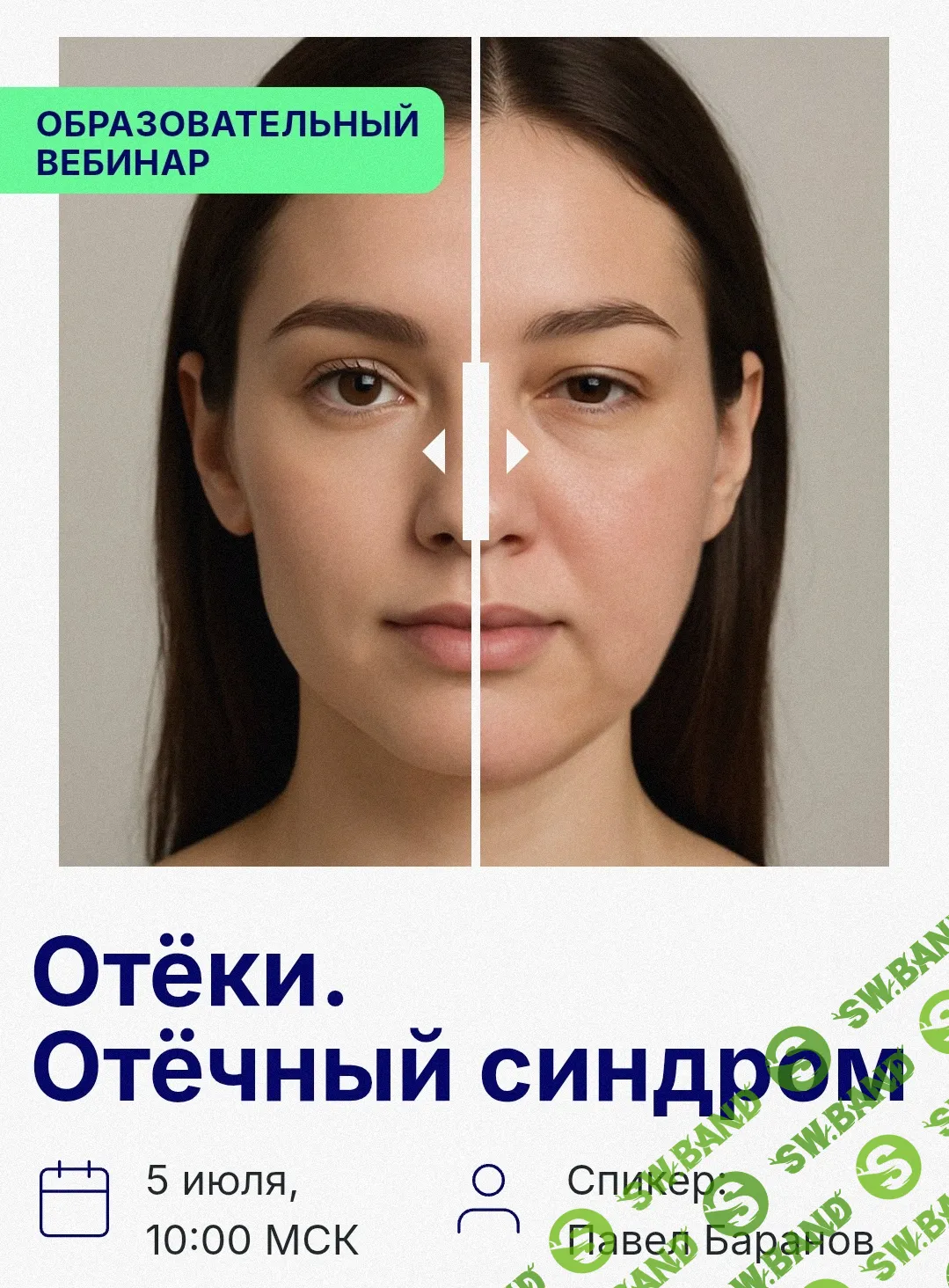 Отеки [Павел Баранов]