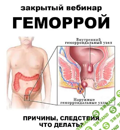 [pravda.pro.pisheprom] Геморрой (2024)