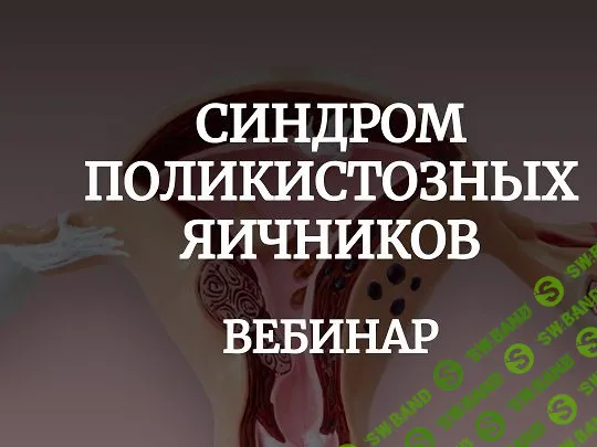 Синдром поликистозных яичников [Валерий Подрубаев]